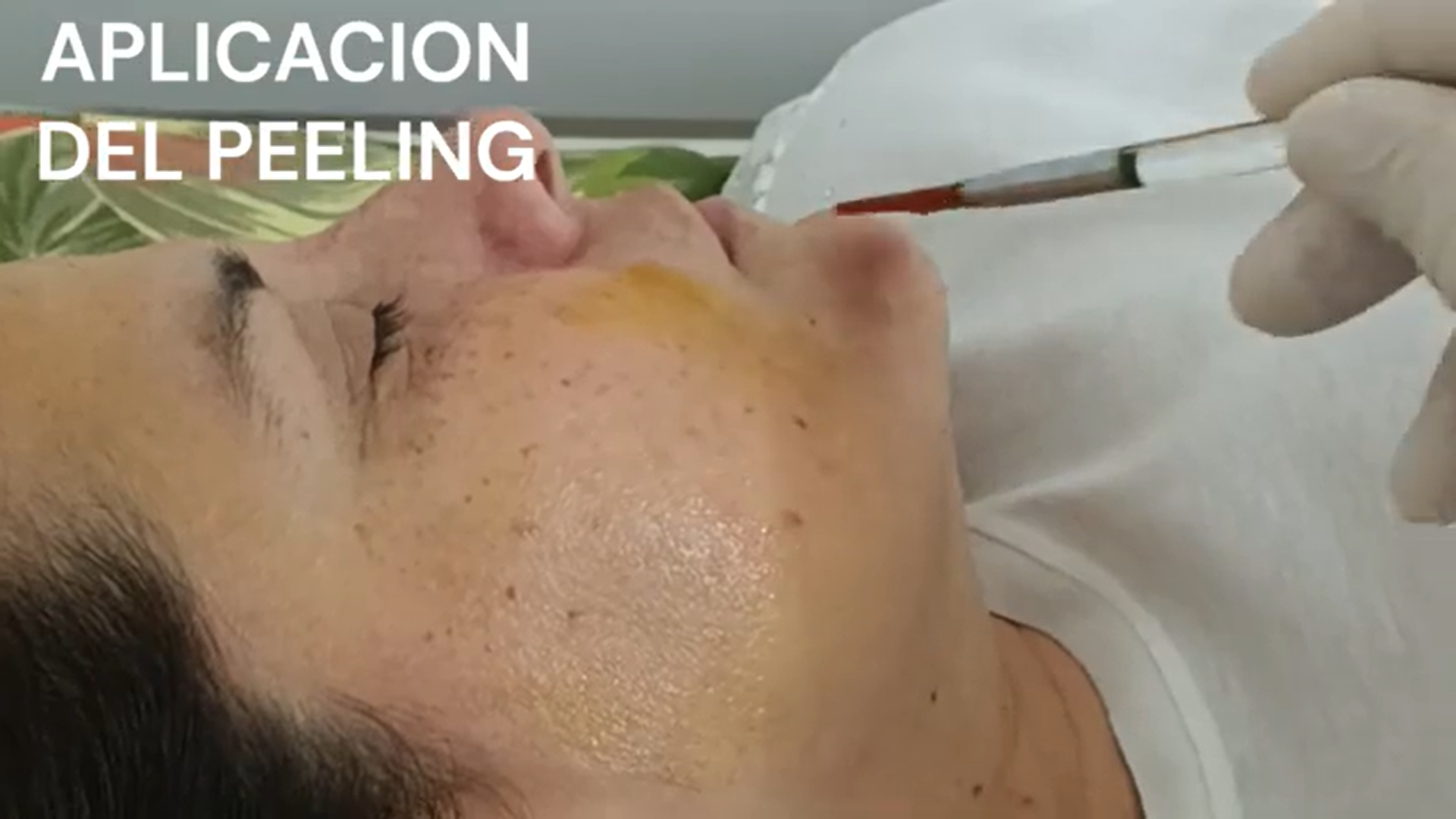 Peeling facial