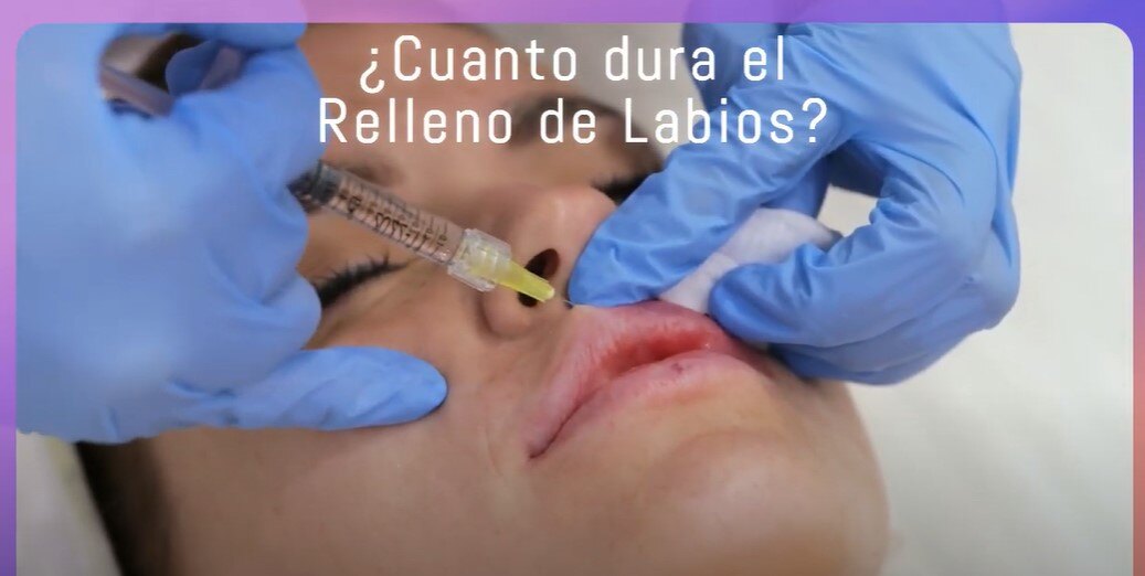 Relleno de labios hialuronico